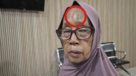 Anak Kandung di Bulukumba Banting dan Hantam Ibu Pakai Helm hingga Nyaris Tewas